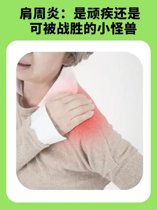 肩周炎.webp.png